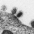 Elektronenmicroscopische opname van MERS-coronavirusdeeltjes, die zich binden aan het oppervlak van menselijke levercellen (beeld: Ronald Limpens en Montserrat Bárcena - LUMC)