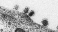 Elektronenmicroscopische opname van MERS-coronavirusdeeltjes, die zich binden aan het oppervlak van menselijke levercellen (beeld: Ronald Limpens en Montserrat Bárcena - LUMC)