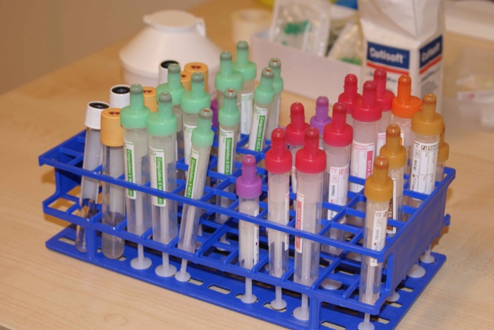 Image of vials for blood extracted from test subjects.