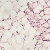 Bruine vetcellen zijn vaak te vinden tussen witte vetcellen. De bruine vetcellen (rechtsboven) bevatten verschillende vetdruppels per cel, terwijl de witte vetcellen een grote vetdruppel per cel bevatten - foto M.J.W. Hanssen.