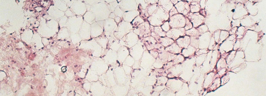 Bruine vetcellen zijn vaak te vinden tussen witte vetcellen. De bruine vetcellen (rechtsboven) bevatten verschillende vetdruppels per cel, terwijl de witte vetcellen een grote vetdruppel per cel bevatten - foto M.J.W. Hanssen.