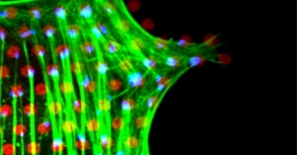 Sarcoma surgeon image
