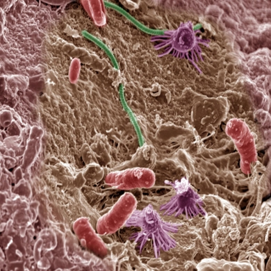 Community of micro-organisms in the soil (© Alice Dohnalkova/PNNL).