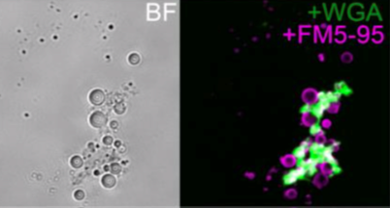 Cell wall-deficient cells of Mycobacterium. Cells were stained with WGA and FM5-95 to visualize cell wall remnants and cell membranes, respectively. Image provided by Noortje Dannenberg.