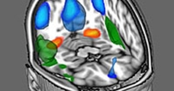 Functional architecture of the brain revealed - Leiden University